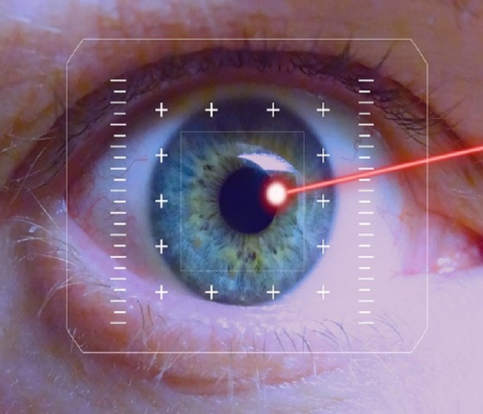 4 Phương pháp Mổ mắt Cận Thị mới nhất hiện nay bệnh nhân Cần Biết