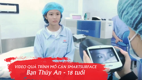 Bạn Thùy An 18 tuổi  – Phẫu thuật cận thị PP SmartSurfACE